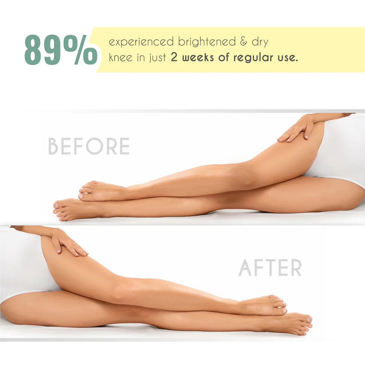 Even Fix Cream 100Gm
