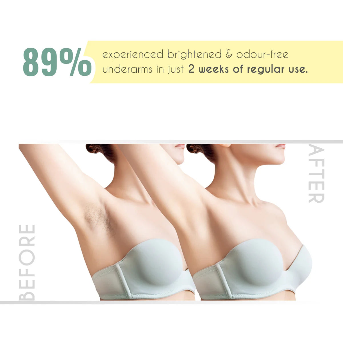 Even Fix Cream 100Gm