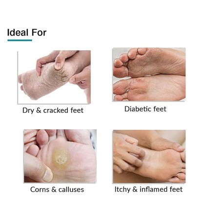 Fixderma Foobetik Cream, Foot cream, Foot care, For Dry & Cracked Feet, Moisturizes & Soothes Feet, Heel Repair, For Calloused, or Chapped Skin, Paraben Free 100gm