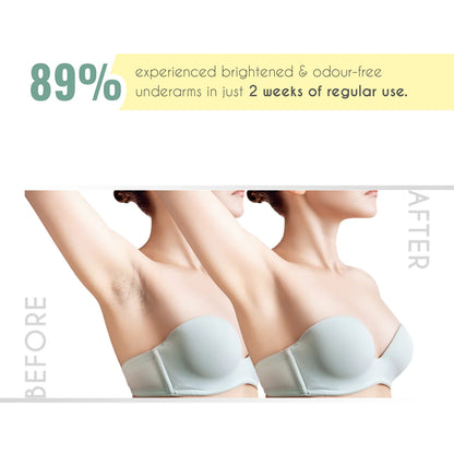 Even Fix Cream 100Gm